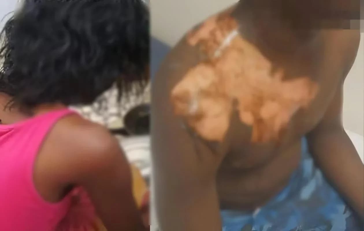 Sénégal : une femme arrêtée pour avoir ébouillanté son mari et sa coépouse à Ross-Béthio